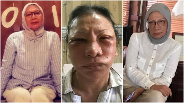 Aktivis perempuan Ratna Sarumpaet. (Foto: Instagram @rsarumpaet, istimewa, twiter @fadlizon)