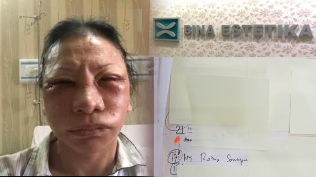 Ilustrasi Ratna Sarumpaet. (Foto: Dok. Istimewa)