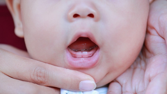 Ilustrasi gigi bayi yang baru lahir. (Foto: Shutter Stock)