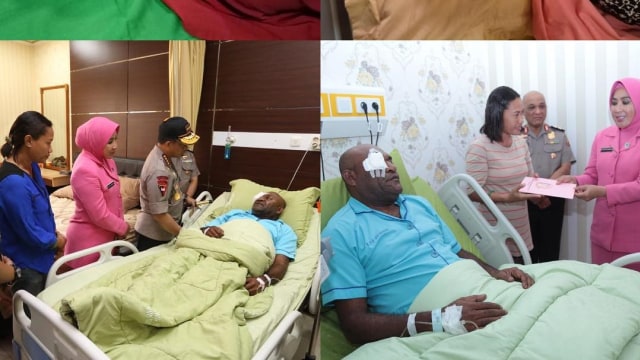 Kondisi Polisi Papua setelah dioperasi di Jakarta, Kamis (11/10/2018). (Foto: Instagram/@krishnamurti_bd91)