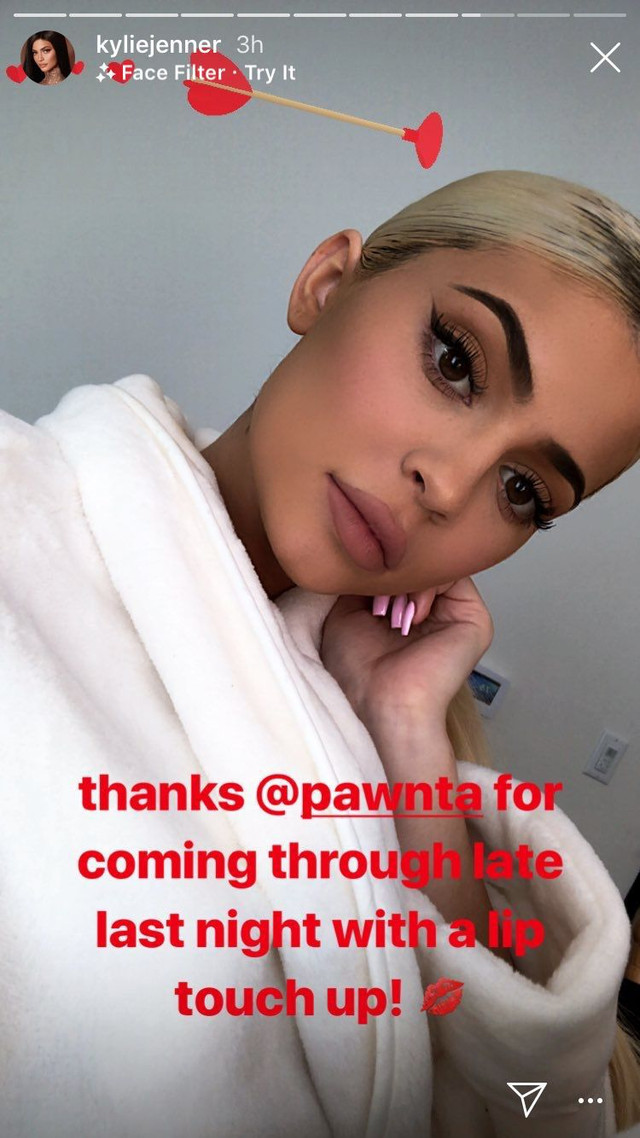 Unggahan Story Instagram Kylie Jenner tentang Lip Filler (Foto: Instagram @kyliejenner)