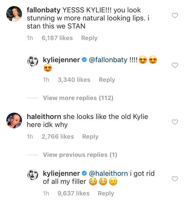 Komentar Kylie Jenner tentang Lip Filler (Foto: Instagram @kyliejenner)