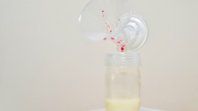 Ilustrasi ASI perah tercampur darah (Foto: Shutterstock)