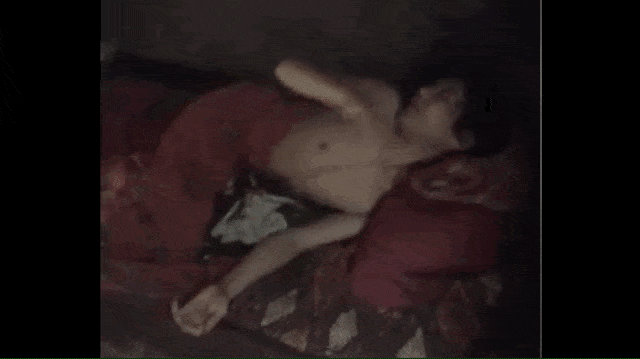 Iwan Muliyadi korban salah tembak alami kelumpuhan (Foto: Dok. PBHI Sumbar)