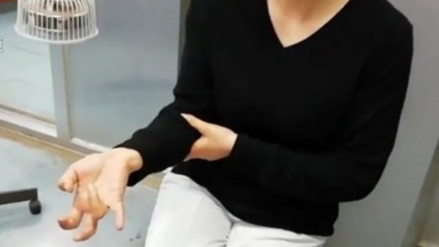 Ilustrasi tangan dipasangi microchip (Foto: Video screengrab/Pear video )