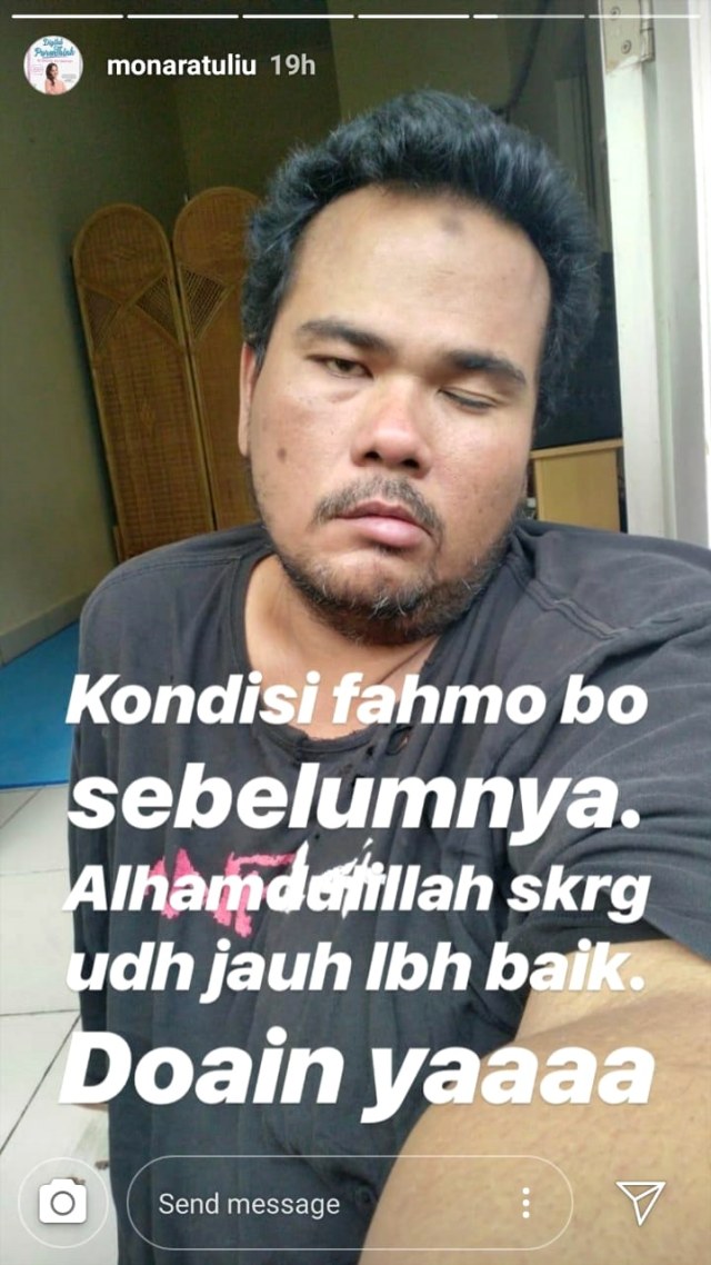 Fahmi Bo sakit stroke. (Foto: Snapgram/@monaratuliu)