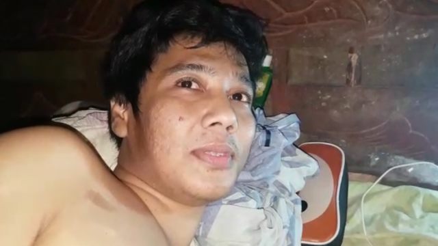 Iwan usai Ditembak Polisi: Lumpuh, Tak Terima Ganti Rugi, dan Mengemis
