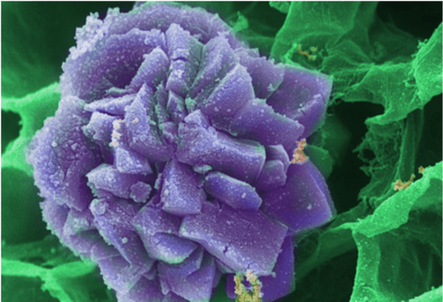 7 Penampakan Ganja jika Dilihat dengan Mikroskop  (5)