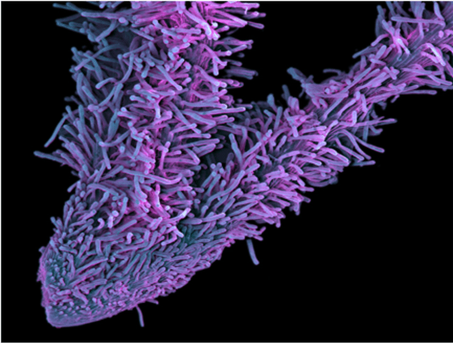 7 Penampakan Ganja jika Dilihat dengan Mikroskop  (7)