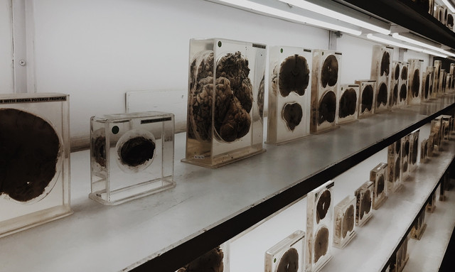 Museum Otak NIMHANS di Bangalore, India (Foto: Instagram betweenblackandbliss)