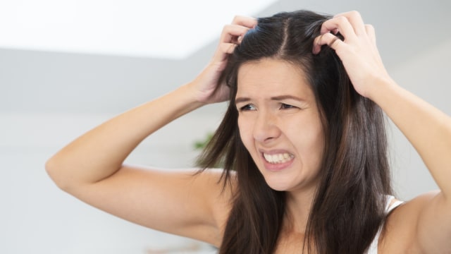 Ilustrasi Ketombe pada ibu hamil. Foto: Shutterstock