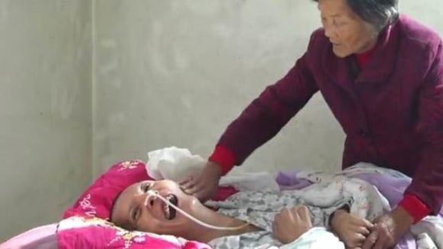 Bangun dari koma selama 12 tahun. (Foto: Dok. Miaopai.com)