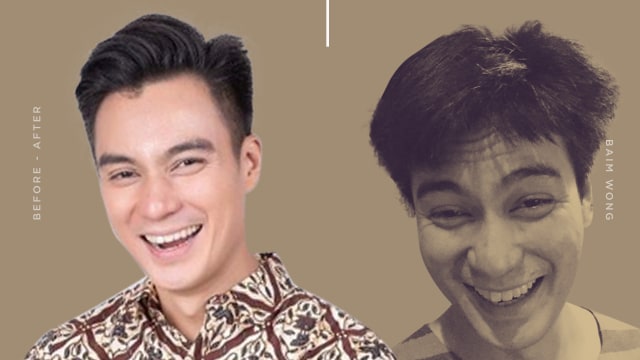 Before After Baim Wong (Foto: Infografik: Nunki Lasmaria Pangaribuan/kumparan)