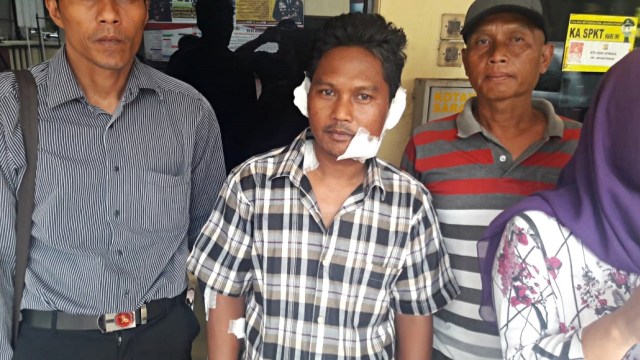 Herman satpam yg digigit pitbull membuat laporan kepada Polisi. (Foto: Dok. Istimewa)