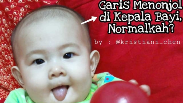Garis Menonjol di Kepala Bayi, Normalkah?