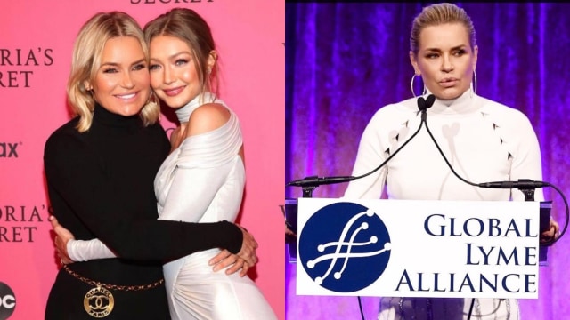 Yolanda Hadid lepas botoks di usia 55 tahun (Foto: dok.Yolanda Hadid)