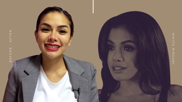 Nikita Mirzani Dulu dan Sekarang (Foto: Infografik: Nunki Lasmaria Pangaribuan)