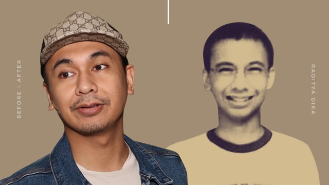 Raditya Dika (Foto: Infografik: Putri Sarah Arifira/kumparan)
