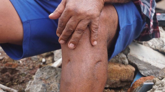 Luka tembak di kaki preman di Terminal Senen. (Foto: Irfan Adi Saputra/kumparan)