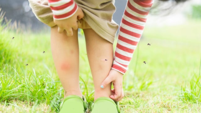 Ilustrasi anak dikerubungi nyamuk Foto: Shutterstock