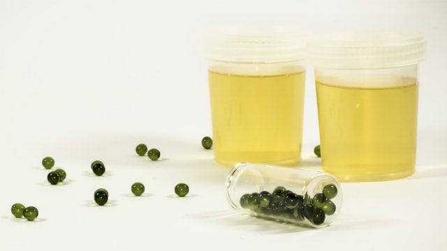 Ilustrasi urine manusia Foto: Pixabay/frolicsomepl