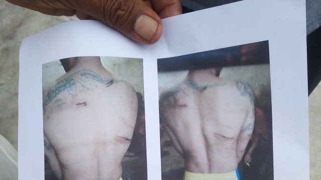 Foto Doni Putra yang diduga dianiaya petugas di Lapas Muaro Padang. (Irwanda/langkan.id)