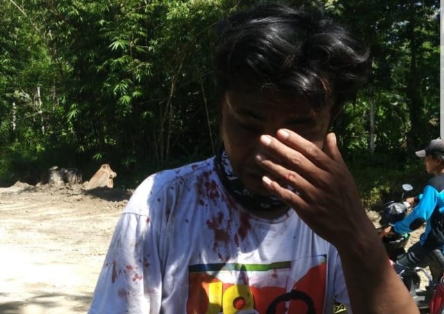 Yuli Wijaya (28), korban pengeroyokan massa pendukung Prabowo-Sandi karena kaus Jokowi. Foto: Istimewa.