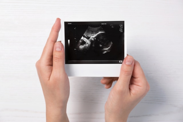 Ilustrasi foto USG Foto: Shutter Stock
