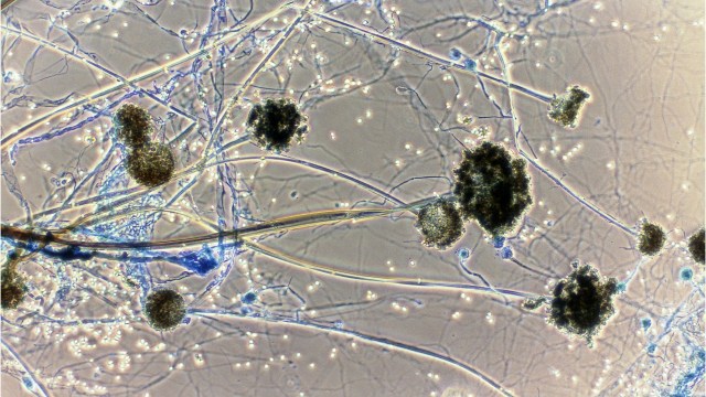 Ilustrasi jamur Foto: id.wikipedia.org