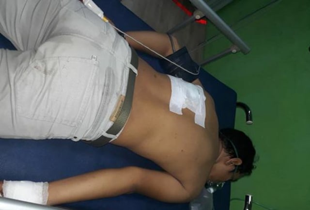 Seorang mahasiswa bernama Ilham Fadli Piliang (20) dirikam di bagian punggungnya. Istimewa
