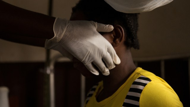 Seseorang terinfeksi Monkeypox di Afrika, yang mendapatkan pengobatan. Foto: AFP