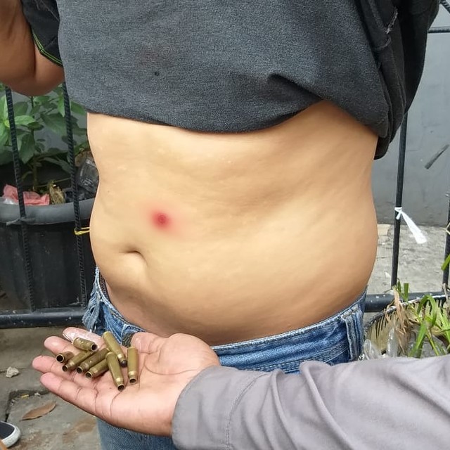 Seorang warga memperlihatkan luka bekas peluru di kawasan Tanah Abang. Foto: Fadjar Hadi/kumparan