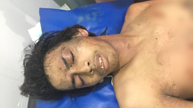 Terduga pelaku bom bunuh diri di Sukoharjo mendapat perawatan. Foto: Dok. Istimewa