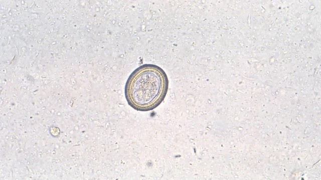 Telur cacing pita. Foto: Centers for Disease Control and Prevention
