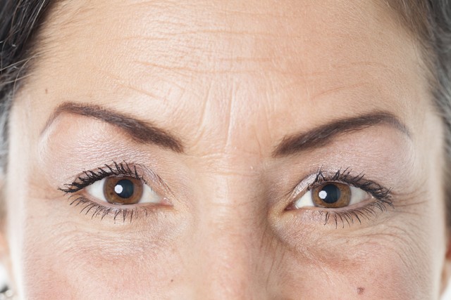 Ilustrasi kerutan di bawah mata. Foto: Shutterstock