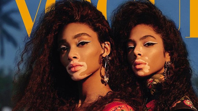 2 Model Virtiligo Sebagai Cover Majalah Vogue Arabia. Foto: Instagram @winnieharlow