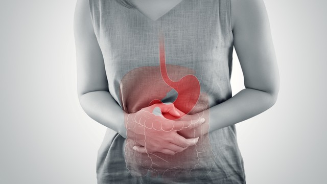 Ilustrasi kanker usus. Foto: Getty Images
