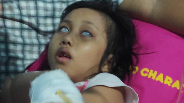 Yunisa Elmira, anak penderita katarak kongenital. Foto: Istimewa