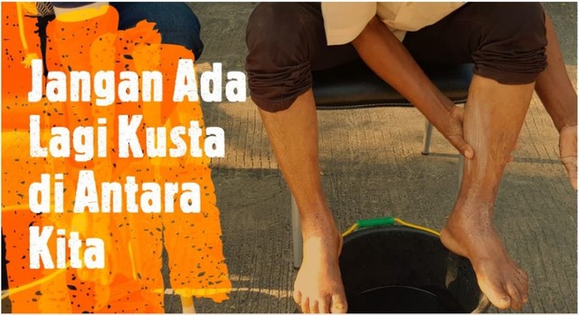 Perjuangan Melawan Stigma terhadap Penderita Kusta