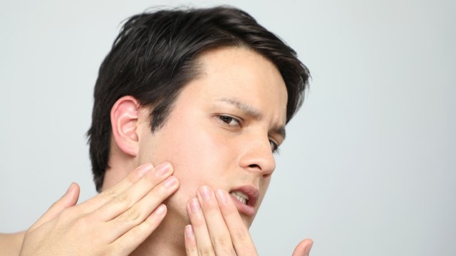Ilustrasi masalah kulit pada pria. Foto: Shutterstock