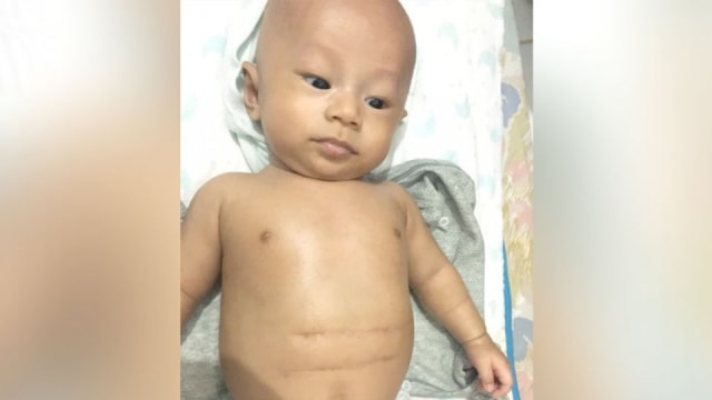 Ketika si Kecil Harus Dioperasi karena Lambungnya Bocor