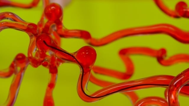 Ilmuwan MIT bikin robot cacing yang bisa bantu obati stroke. Foto: Massachusetts Institute of Technology (MIT)