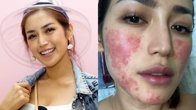 Jessica Iskandar. Foto: Ronny dan Instagram/@inijedar