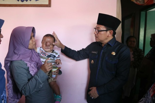 Arsa Adi Pratama saat dijenguk oleh Wali Kota Malang Sutiaji (kanan), beberapa waktu lalu. Foto dokumen.