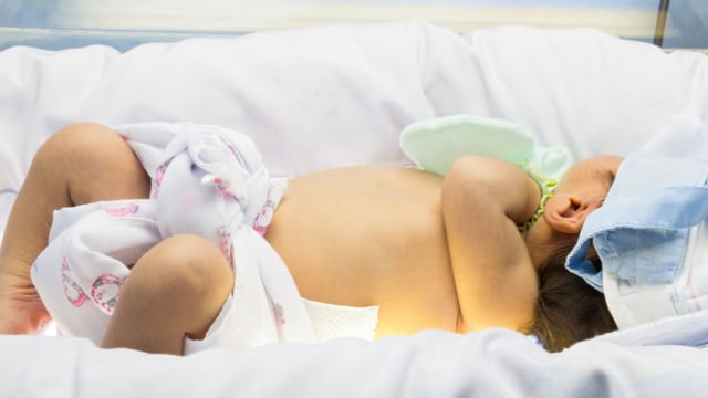 Ilustrasi bayi dengan penyakit kuning. Foto: Shuttestock