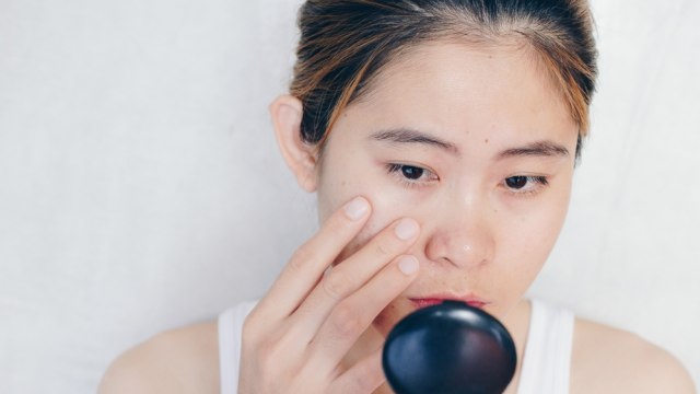 Ilustrasi perempuan sedang memperhatikan bekas jerawat. Foto: Shutterstock