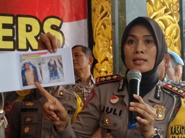 Kasat Lantas Polrestabes Medan AKBP Juliani saat menunjukkan luka yang dialami Golfrid. Foto: Rahmat Utomo/kumparan