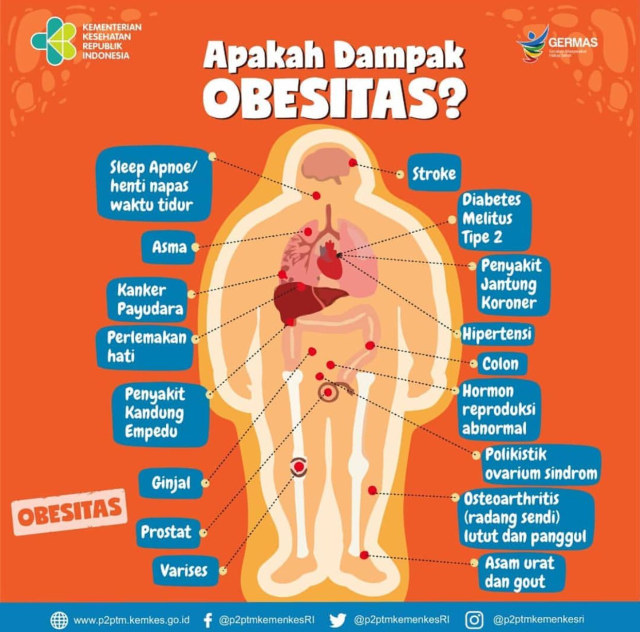 Dampak lanjutan dari obesitas. Sumber: instagram @p2ptmkemenkesRI