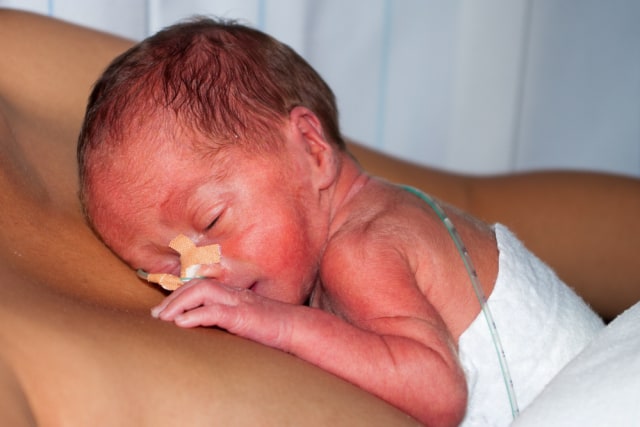 Ilustrasi Bayi Prematur. Foto: Dok. Shutterstock