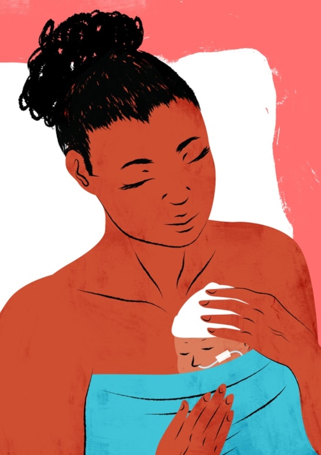 Perawatan Metode Kanguru Foto: Shutter Stock